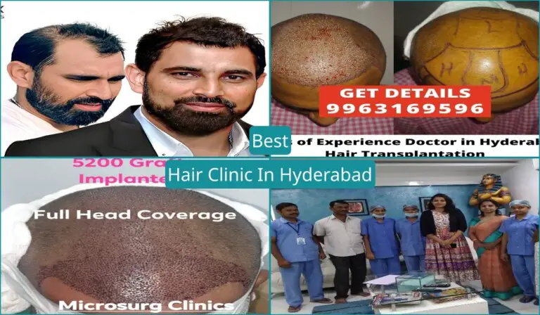 Best Hair Clinic In Hyderabad