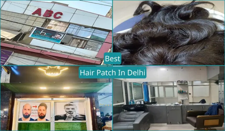 Best Hair Patch In Delhi