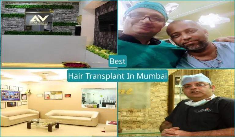 Best Hair Transplant In Mumbai